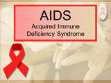 AIDS PowerPoint Presentation